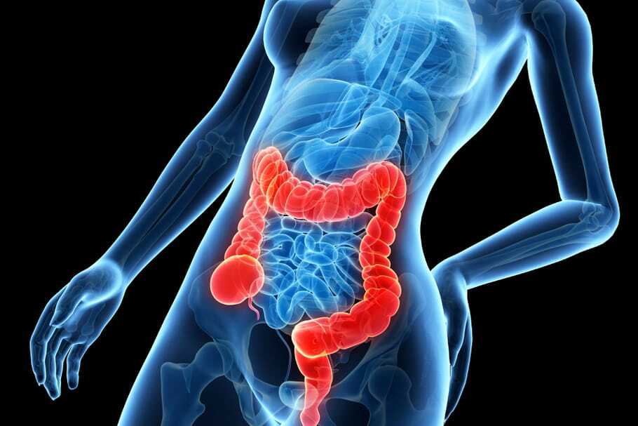 Ilda Calakovic - Diététicienne - Nutritioniste au Luxembourg (Pétange) - Cancer colorectal et facteurs favorissants Ilda Calakovic - Diététicienne - Nutritioniste au Luxembourg (Pétange) - Cancer colorectal et facteurs favorissants